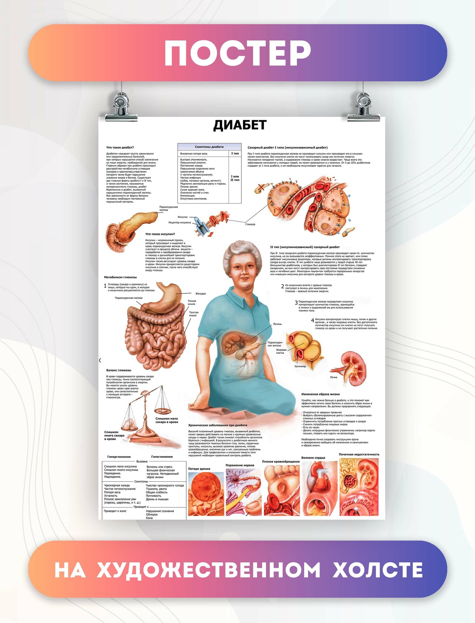 Постеры диабет болезни медицина (20)