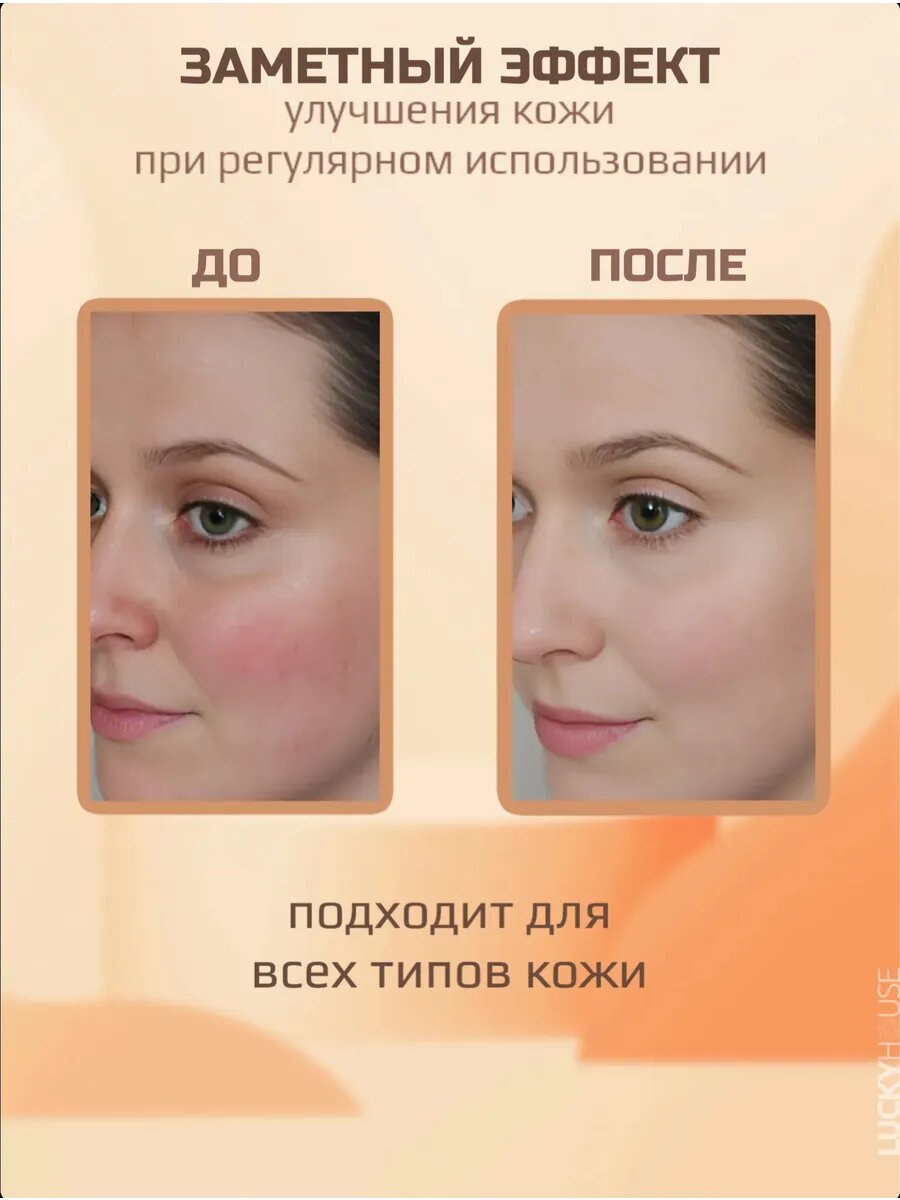 Лосьоны Для Лица Holy Land Лосьон для растворения комедонов SUPER LOTION