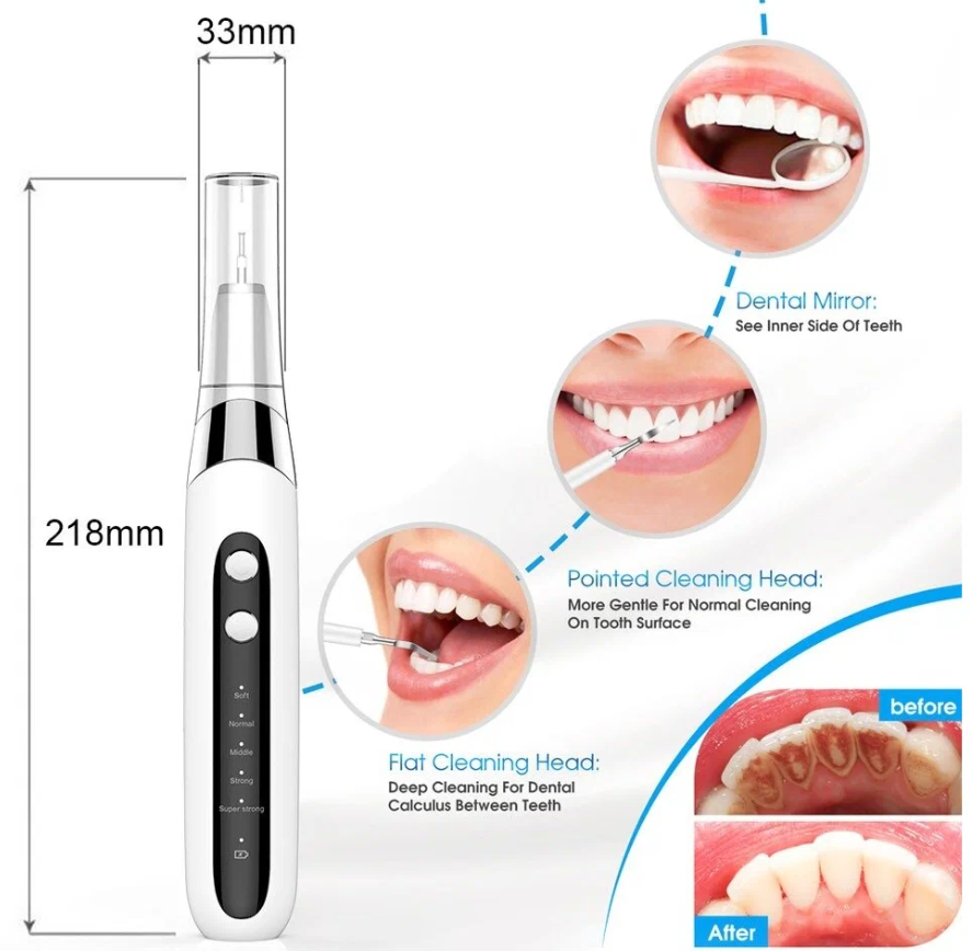 Скалер стоматологический портативный / Скалер для удаления зубного камня / Скалер для отбеливания и чистки зубов - фотография № 5