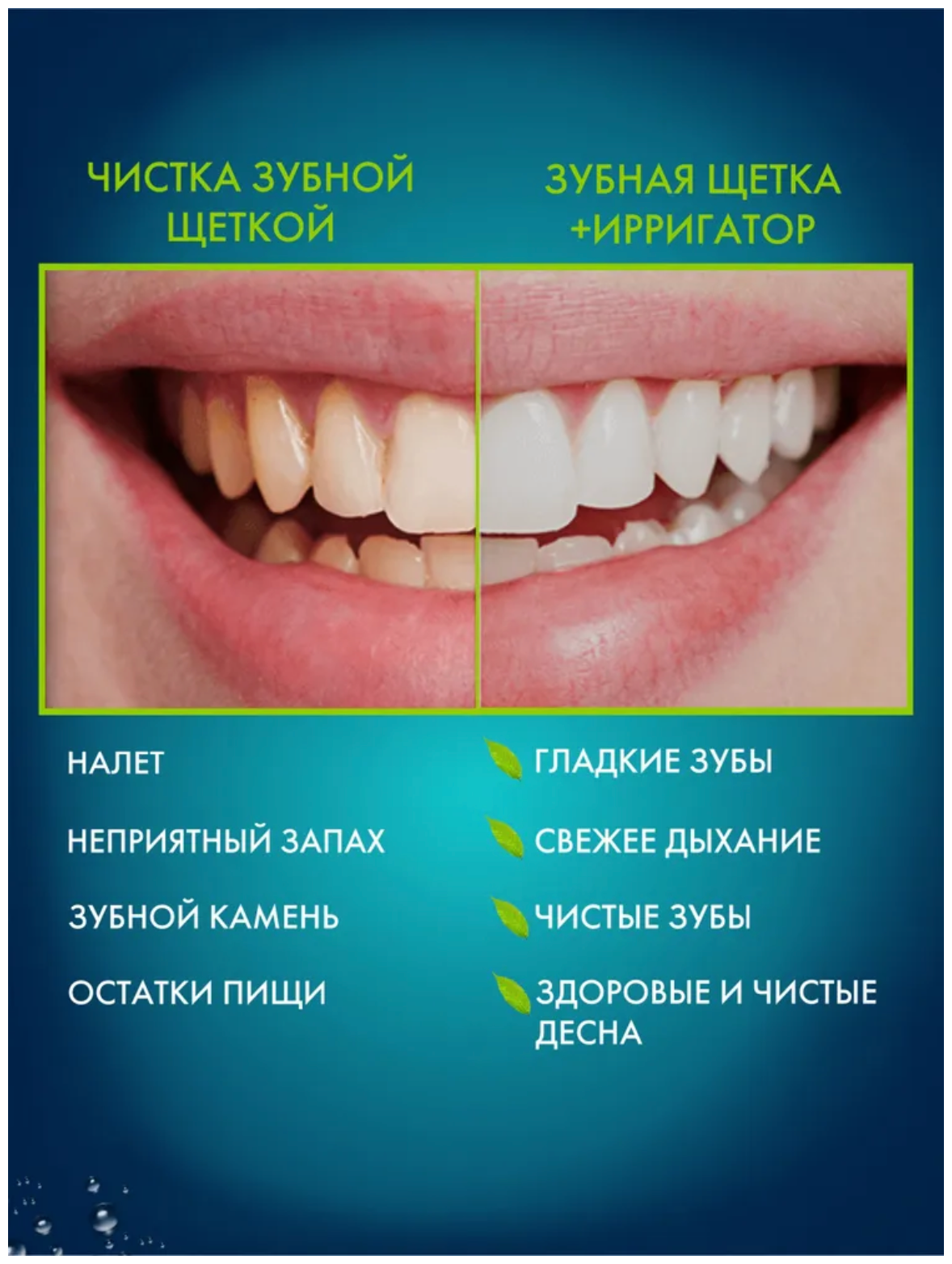 Портативный ирригатор для очистки зубов, ирригатор для полости рта и очистки языка, с насадками в комплекте - фотография № 4