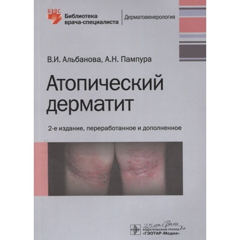Атопический дерматит (Альбанова Вера Игоревна, Пампура Александр Николаевич) - фото №2