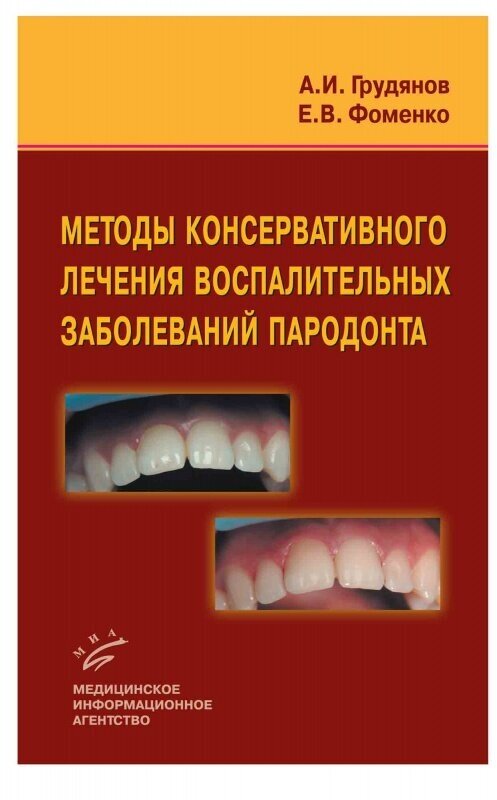 Грудянов А. И, Фоменко Е. В. "Методы консервативного лечения воспалительных заболеваний пародонта"