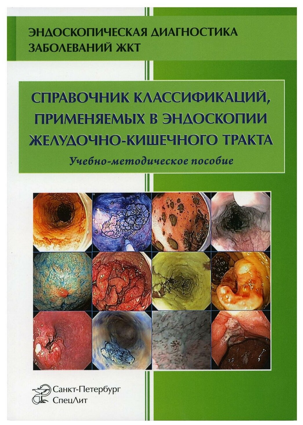Справочник классификаций, применяемых в эндоскопии желудочно-кишечного тракта - фото №1