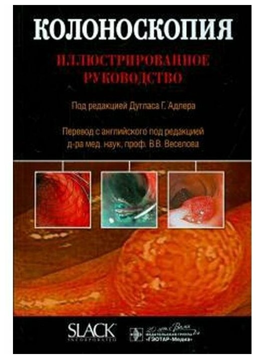 Адлер Д. Г. ; Пер. с англ. И. С. Козловой; "Колоноскопия : иллюстрированное руководство"