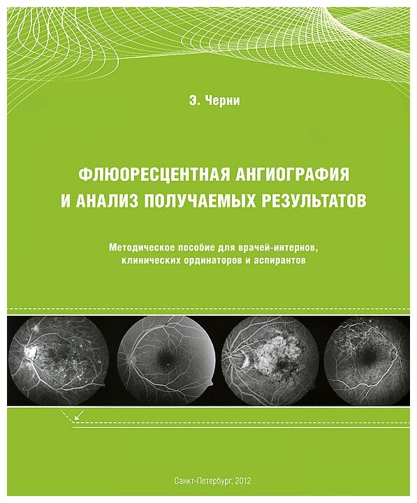 Флюоресцентная ангиография и анализ получаемых результатов: Методическое пособие для врачей-интернов, клинических ординаторов и аспирантов - фото №1