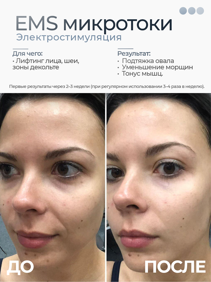 Изображение Микротоковый массажер с вибрацией для лица и шеи, для тела EMS-массажер