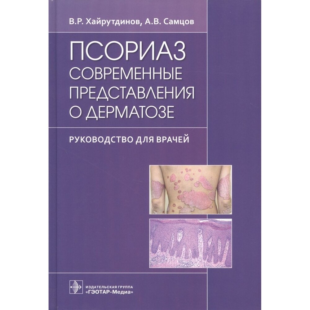 Псориаз. Современные представления о дерматозе. Руководство для врачей - фото №2