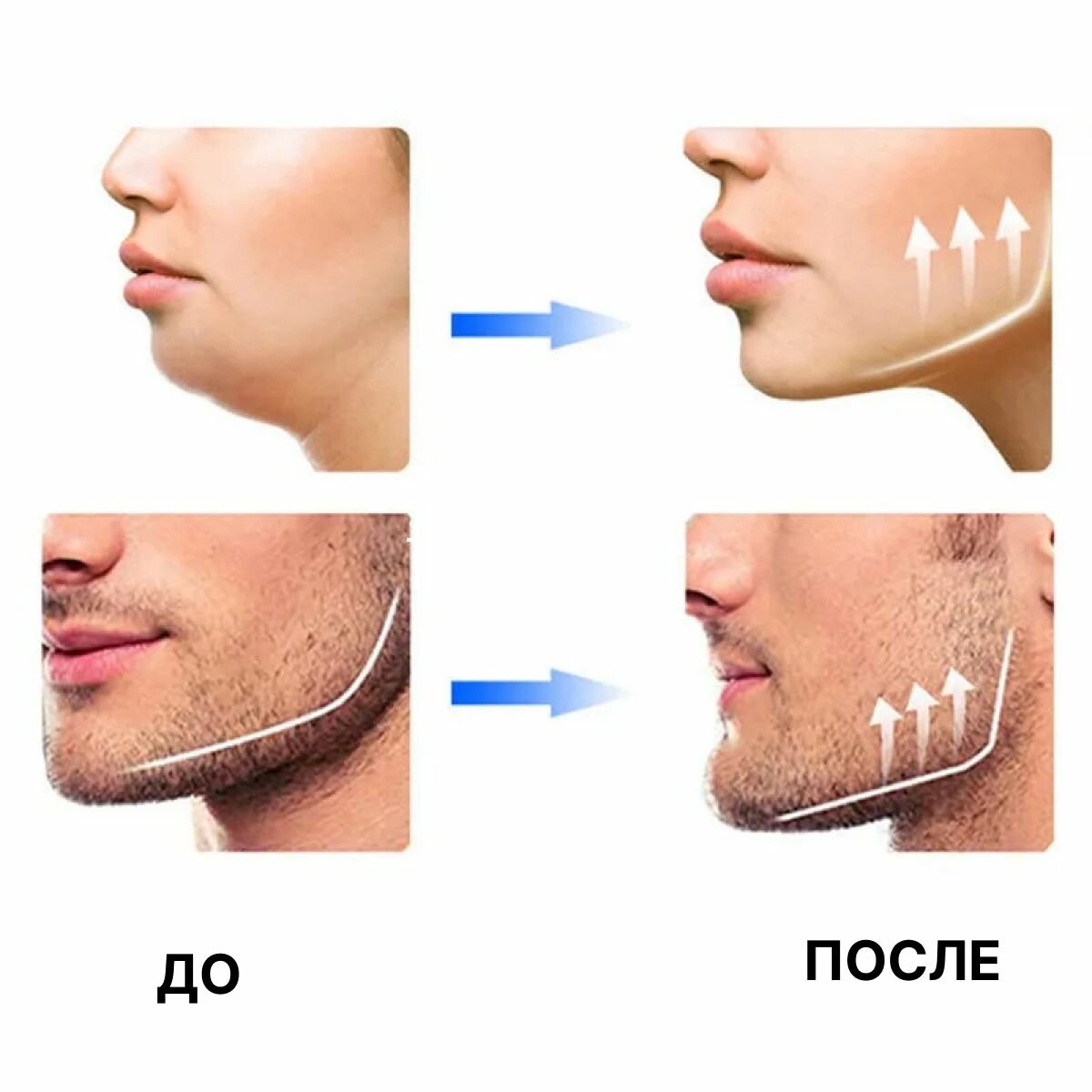 Эспандер/Тренажёр для скул/челюсти/мышц лица, 2 шт, 30 кг — фото 1