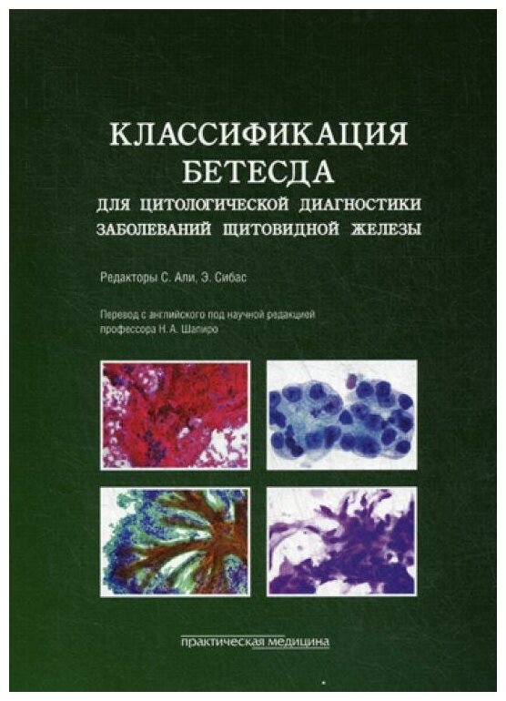 Классификация Бетесда для цитологической диагностики заболеваний щитовидной железы: терминология, критерии и пояснения