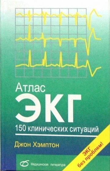 Атлас ЭКГ. 150 клинических ситуаций - фото №1