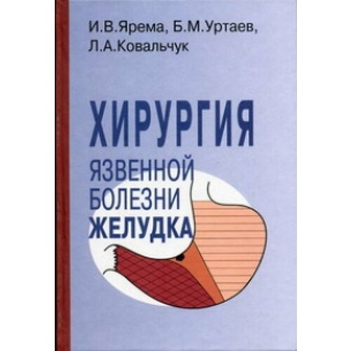 Хирургия язвенной болезни желудка: Руководство для врачей