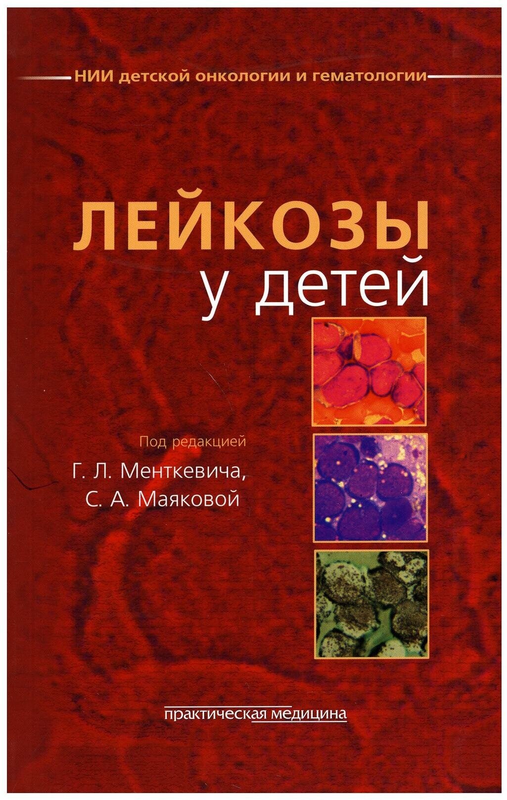 Лейкозы у детей (Менткевич Георгий Людомирович, Маякова Светлана Александровна, Барышников А. Ю.) - фото №1