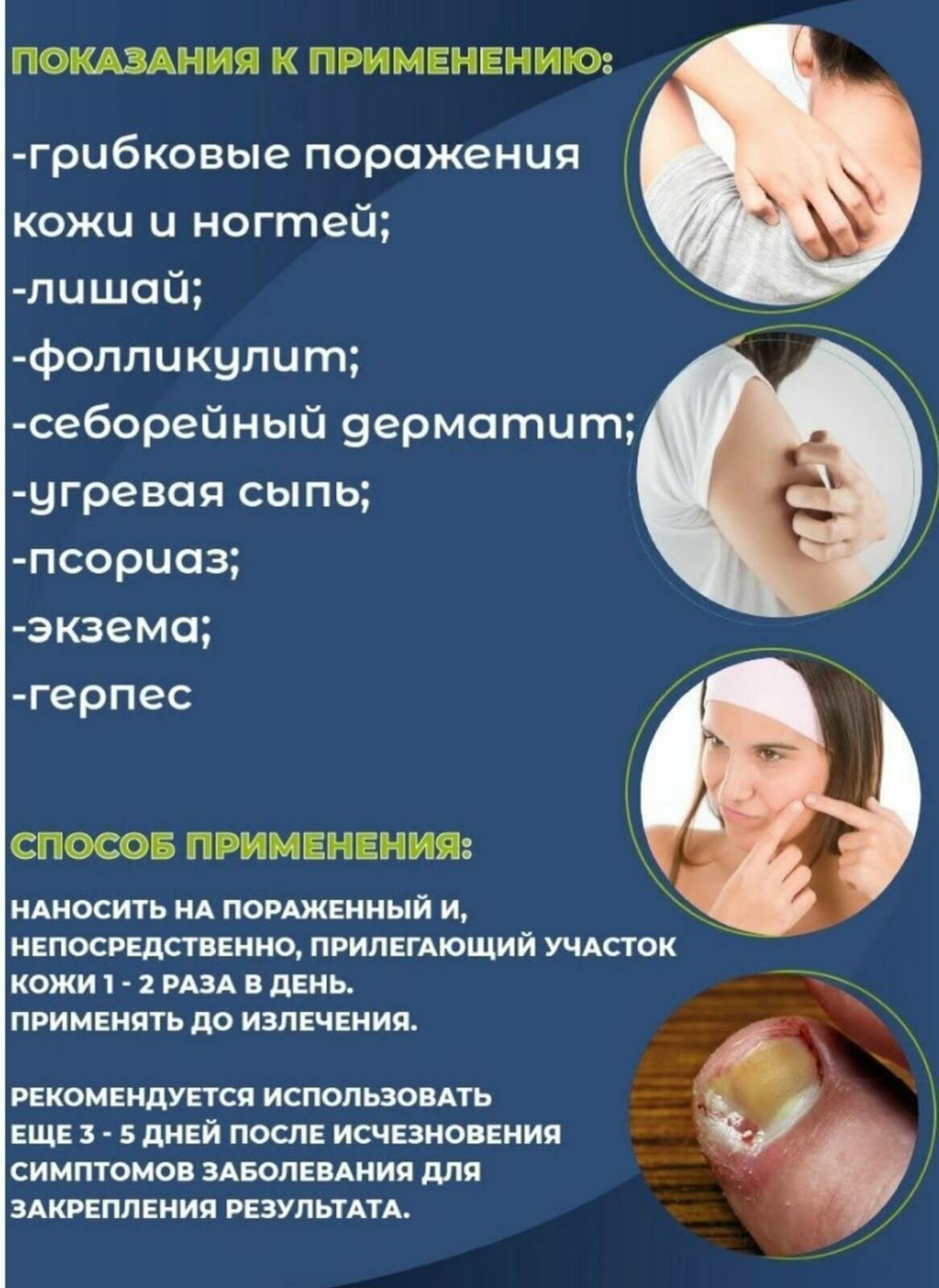 Картинки Крем-мазь король кожи от псориаза, дерматита, экземы / Китайская мазь от псориаза, зуда, шелушения, высыпания, герпеса, ветряной оспы / Средство от псориаза