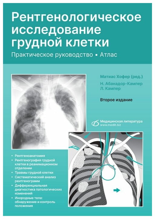 Рентгенологическое исследование грудной клетки. Практическое руководство. Атлас - фото №1