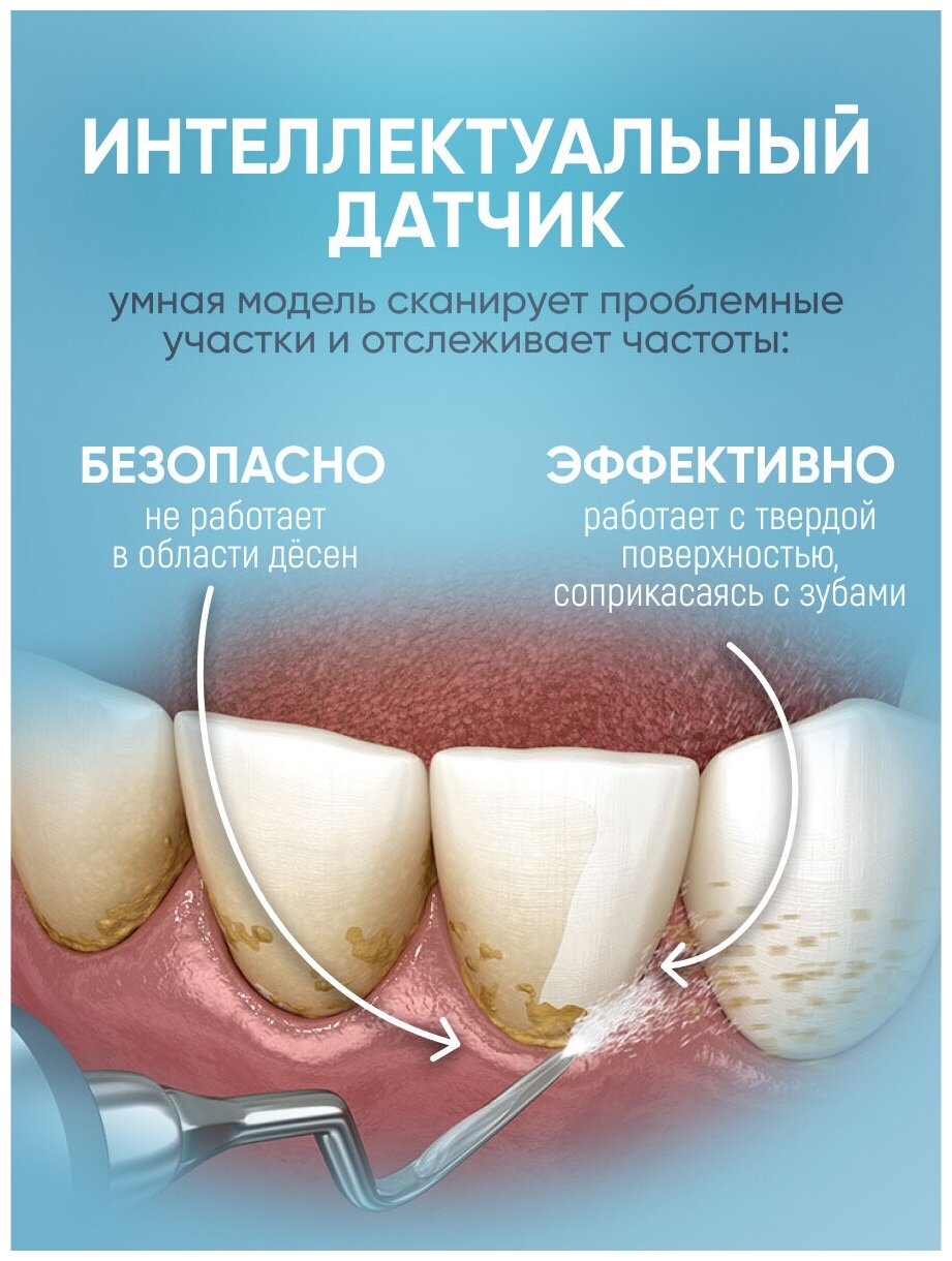 Ультразвуковой скалер для удаления зубного камня My Brilliant Smile 4 насадки - фотография № 12