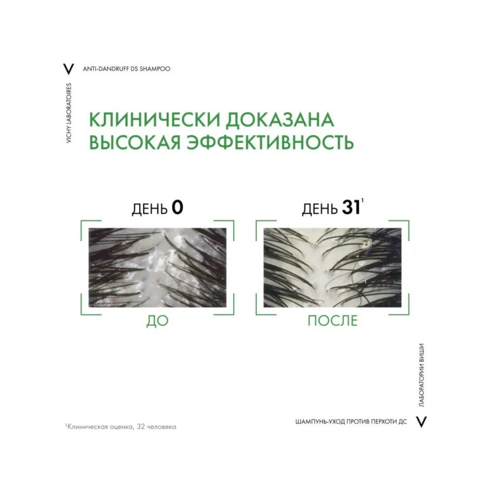 Шампунь-уход Vichy (Виши) Dercos DS интенсивный против перхоти для нормальных и жирных волос 390 мл Продуктос Капилярес Л'Ореаль С.А. - фото №8