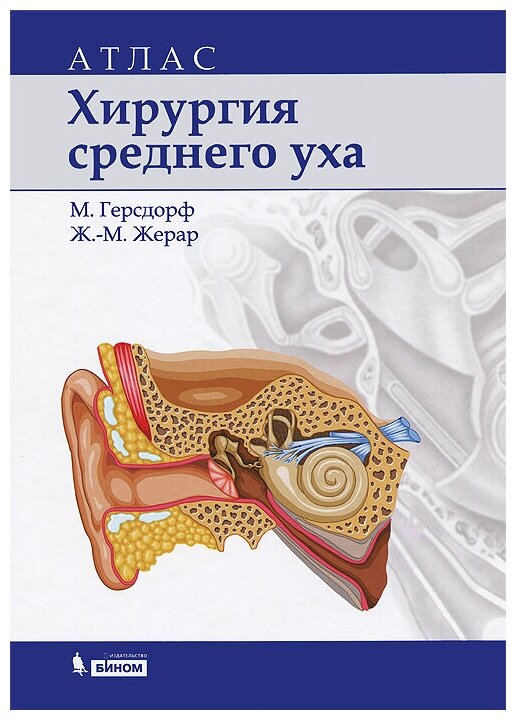 Хирургия среднего уха. Атлас (Герсдорф Мишель, Жерар Жан-Марк) - фото №1
