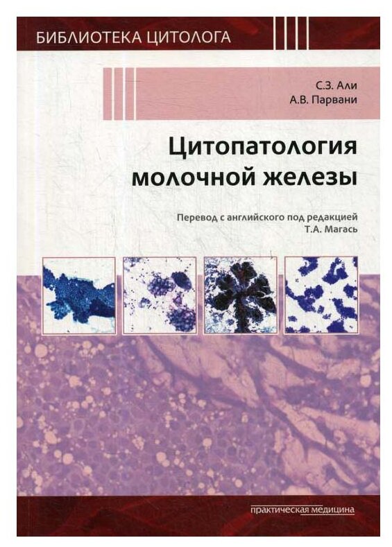 Цитопатология молочной железы (Али С., Парвани А.) - фото №1