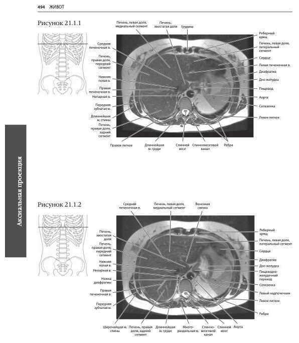 МРТ и КТ. Секционная анатомия (Марк В. Андерсон, Майкл Дж. Фокс) - фото №6