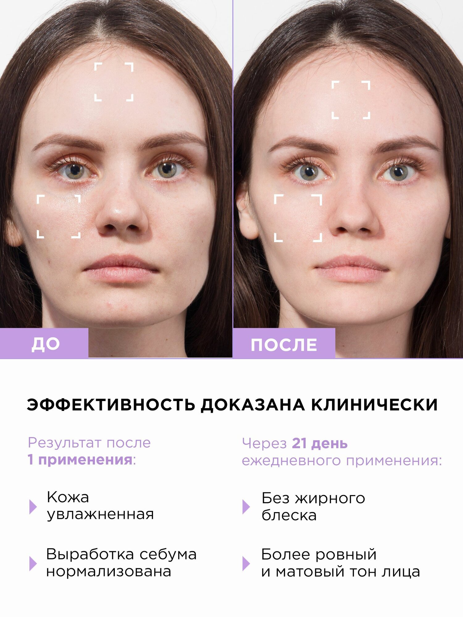 Картинки MIXIT Крем для лица увлажняющий матирующий с ниацинамидом и цинком LAB, 150 мл