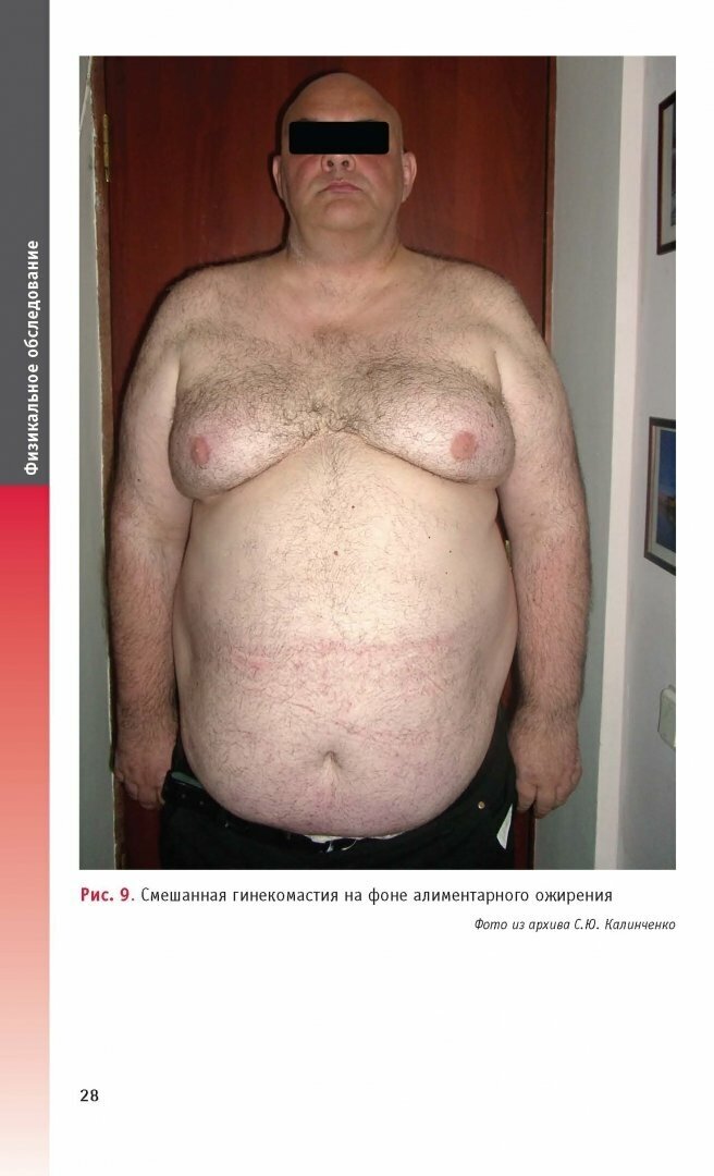 Ожирение и метаболический синдром у мужчин. State of Art - фото №5