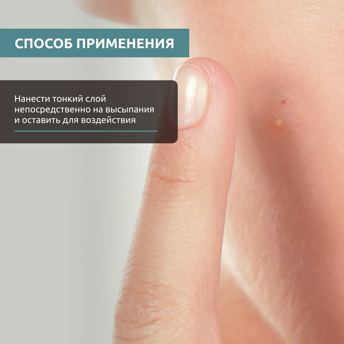 Sesderma Точечный корректор , 15 мл (Sesderma, ) - фото №13