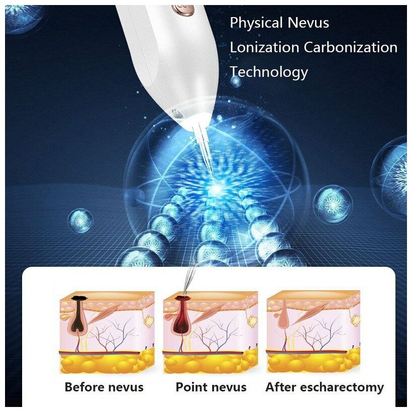 Косметологический аппарат Plasma Pen — плазменный коагулятор, лазер для удаления родинок, пигментации, веснушек, папиллом, бородавок, тату. Белый.