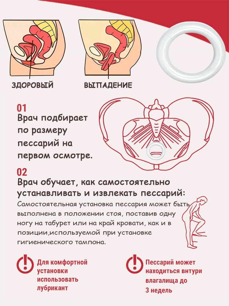 Изображение Пессарий гинекологический