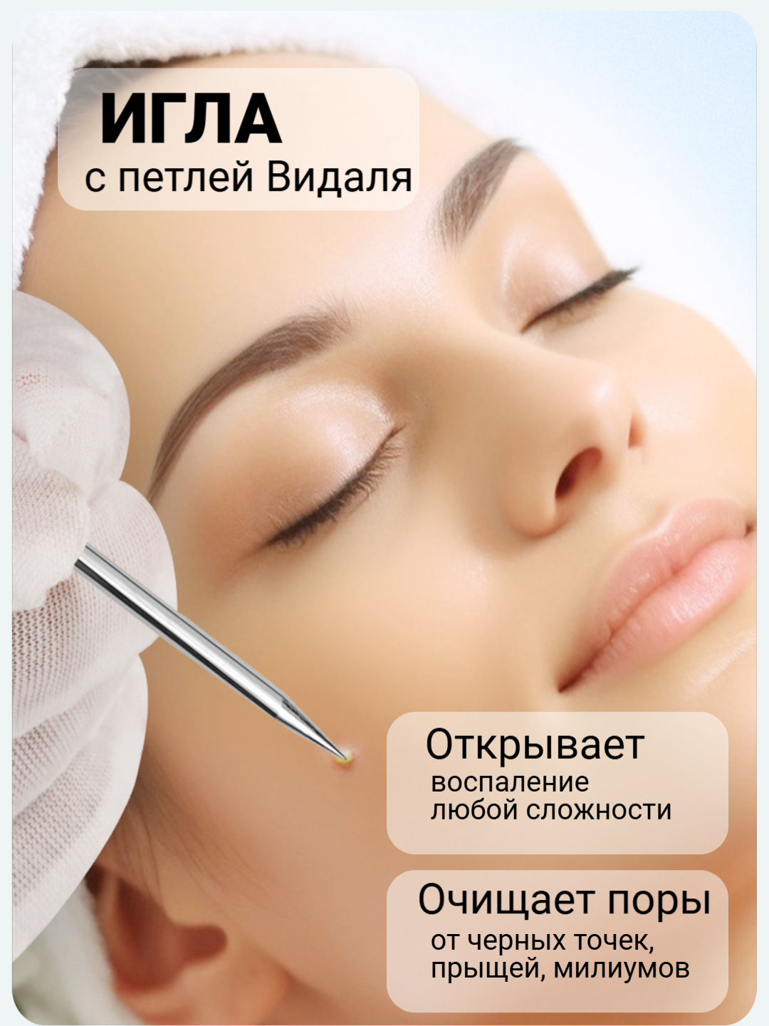 Патчи от прыщей "Петля Видаля" без спирта, салициловая кислота, 36шт. — фото 1