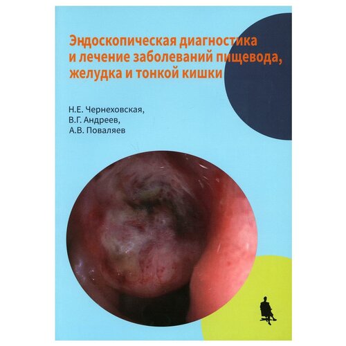 Эндоскопическая диагностика лечение заболеваний пищевода, желудка и тонкой кишки