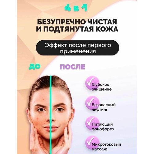 MostBeauty Ультразвуковой аппарат для чистки лица от прыщей и черных точек скрабер для кожи омолаживает 42400₽