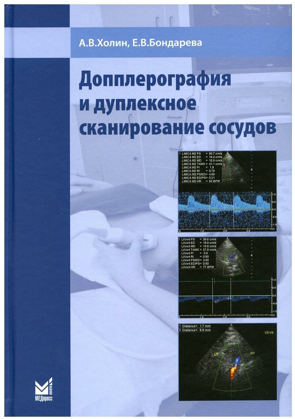 Допплерография и дуплексное сканирование сосудов. 2-е изд