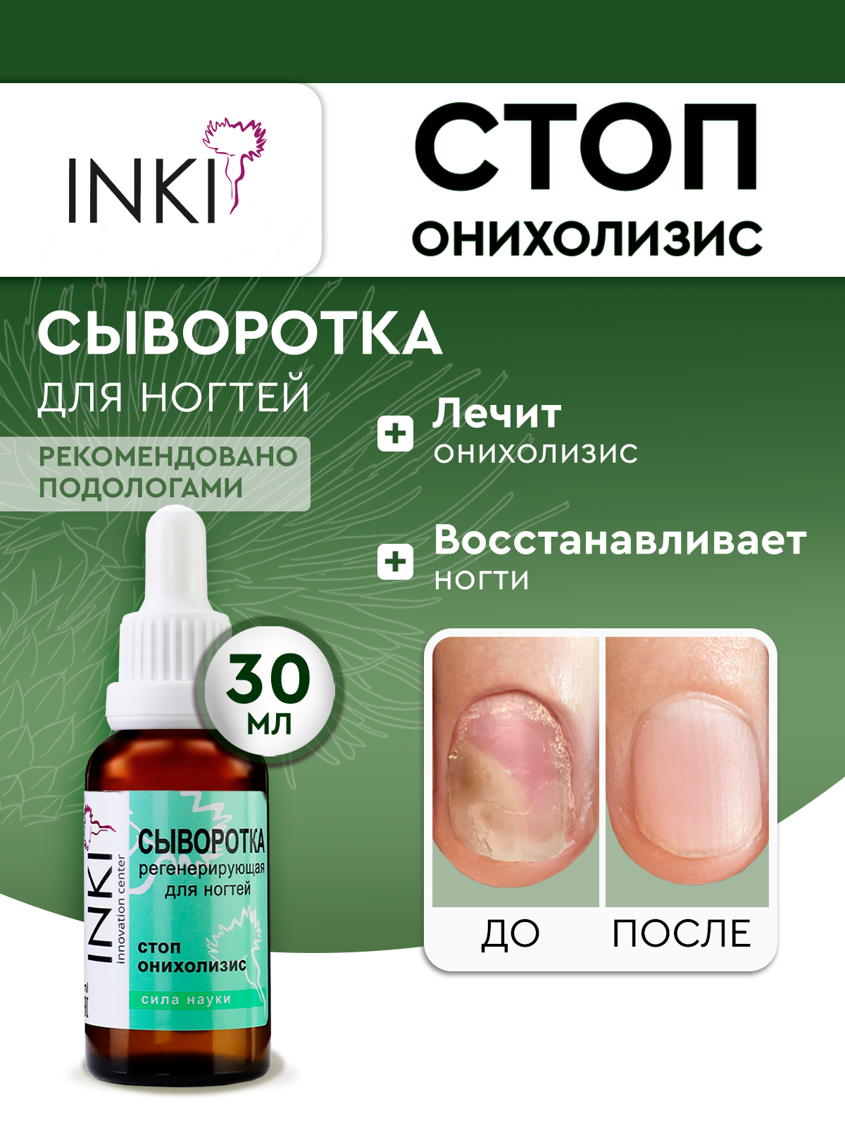 Сыворотка для ногтей INKI "Стоп Онихолизис" против отслоения, 30 мл