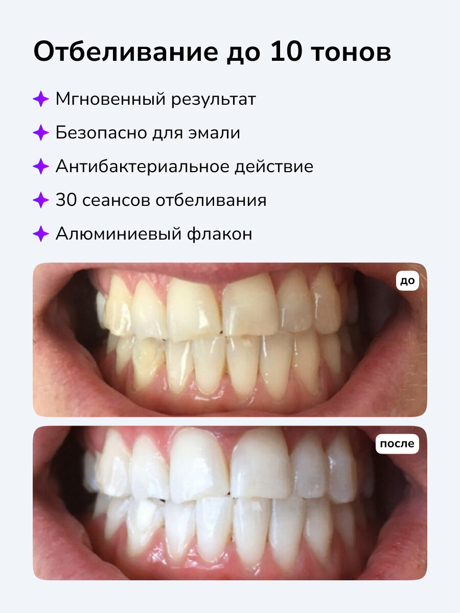 Картинки Карандаш для отбеливания зубов Smilebe 2 шт, 30 сеансов.
