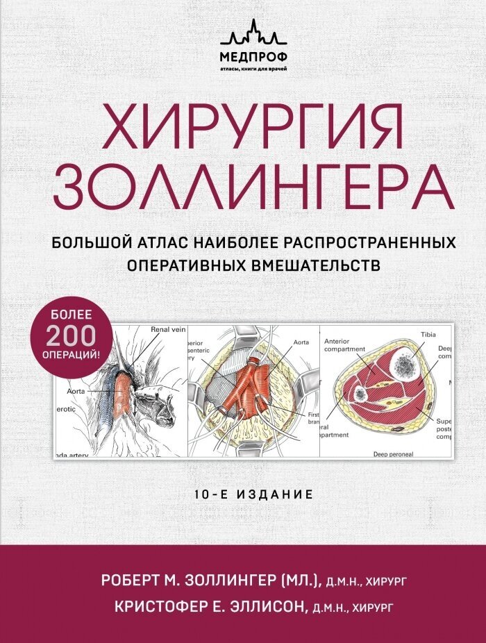 Хирургия Золлингера. Большой атлас наиболее распространенных оперативных вмешательств - фото №1