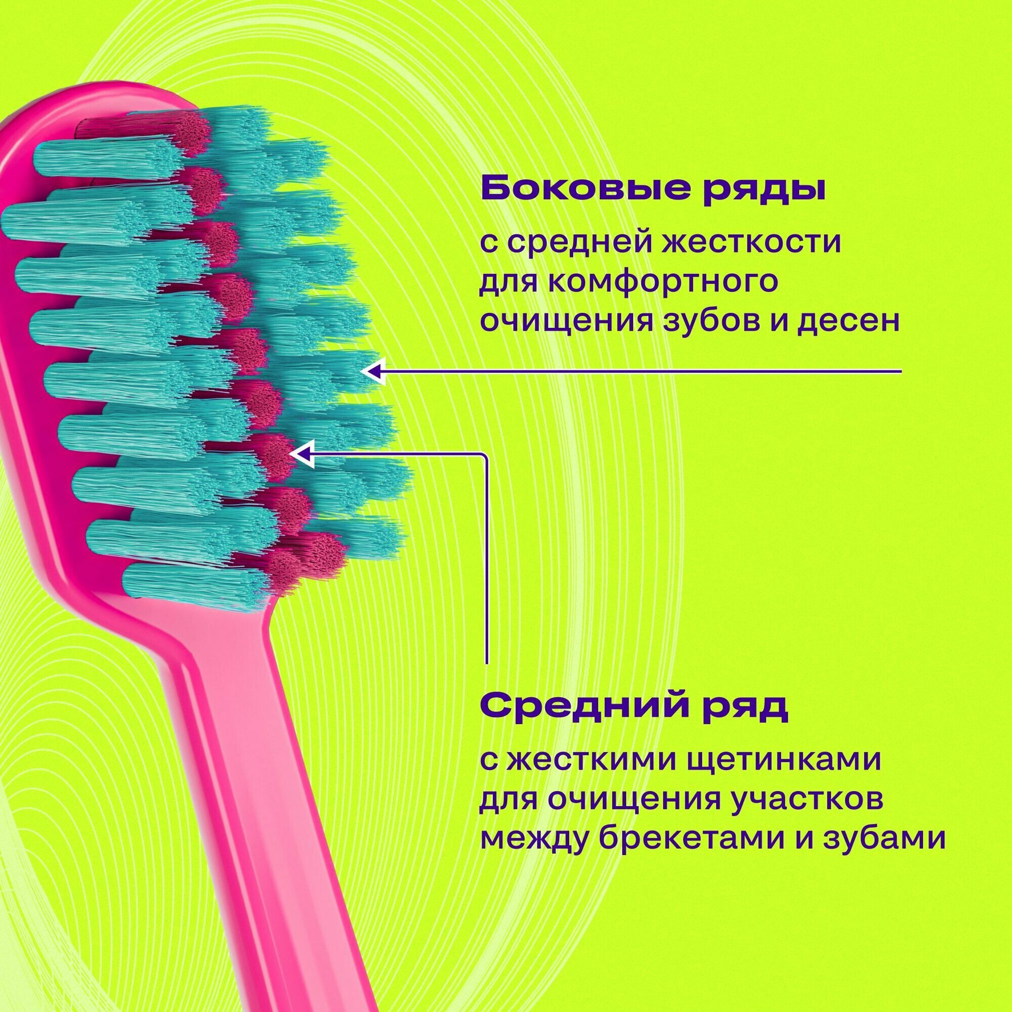 Зубная щетка Global White "ORTO", ортодонтическая, нескользящая, розовая, 2 ряда щетинок — фото 1