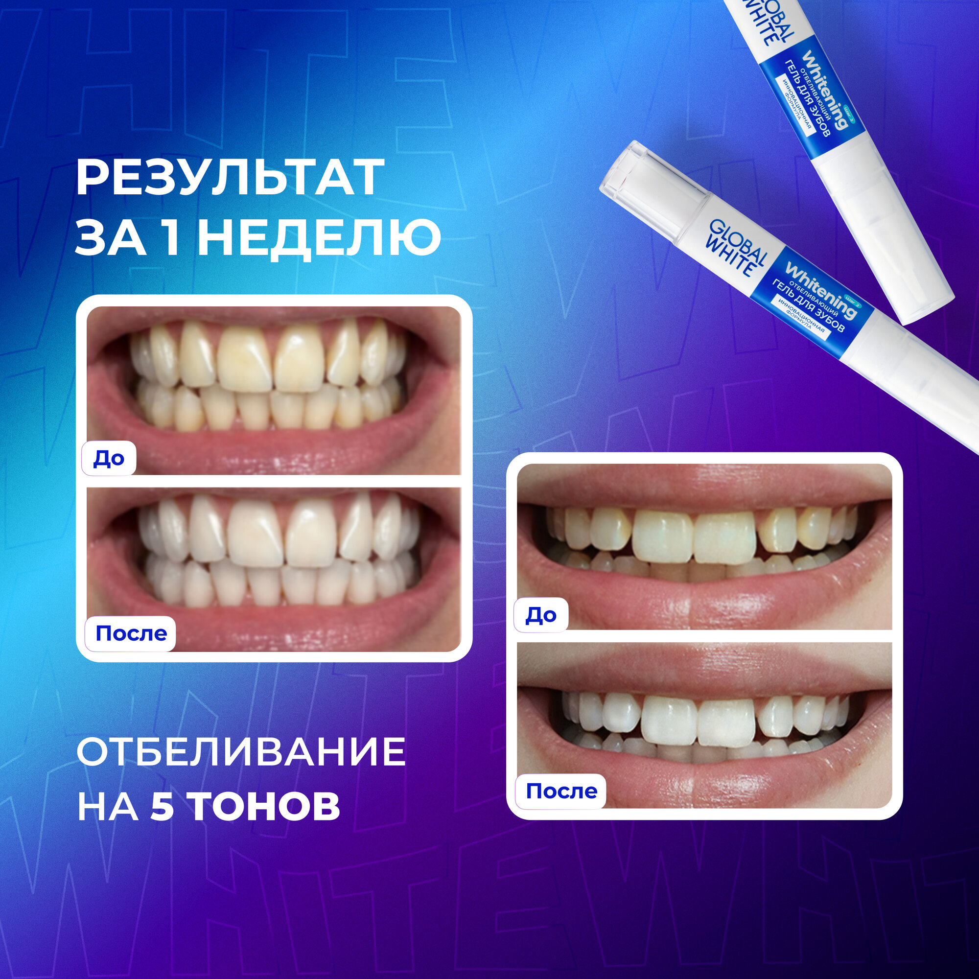 Отбеливающий гель для зубов в карандаше GLOBAL WHITE Whitening Gel for Teeth /5 мл