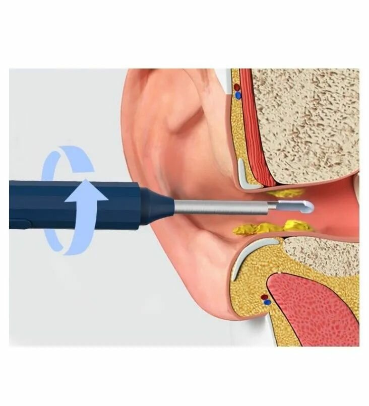 Умная ушная палочка / Портативный отоскоп с камерой