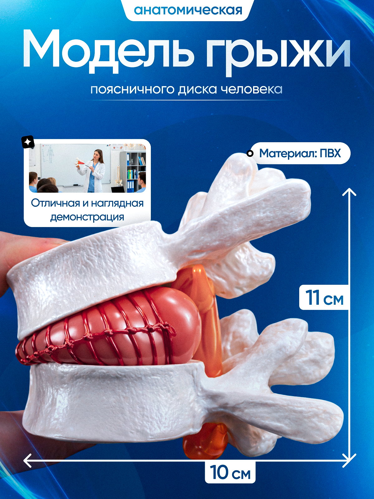 Анатомическая модель грыжи поясничного диска человека Corpo de Hernia