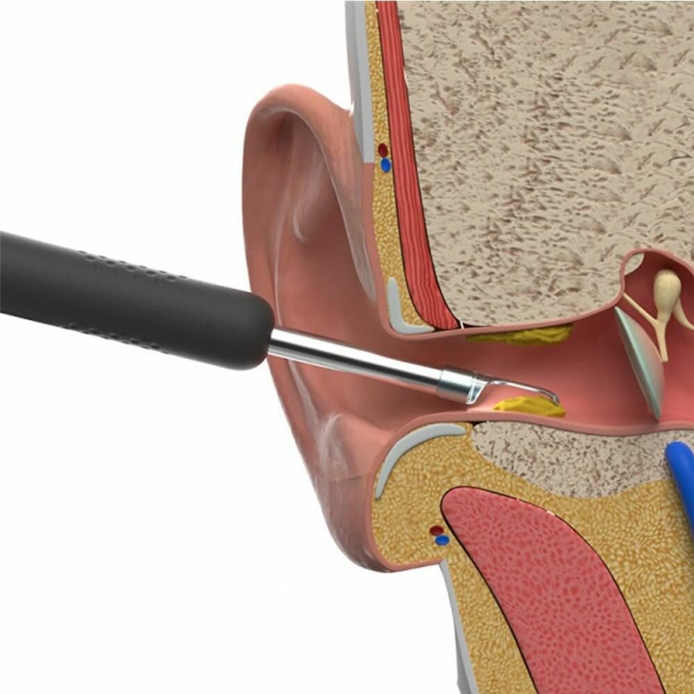 Ушные Палочки Xiaomi Умная ушная палочка Xiaomi Bebird Smart Visual Spoon Ear Stick R1 Black