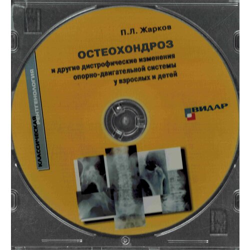 CD Остеохондроз и другие дистрофические изменения опорно-двигательной системы у взрослых и детей