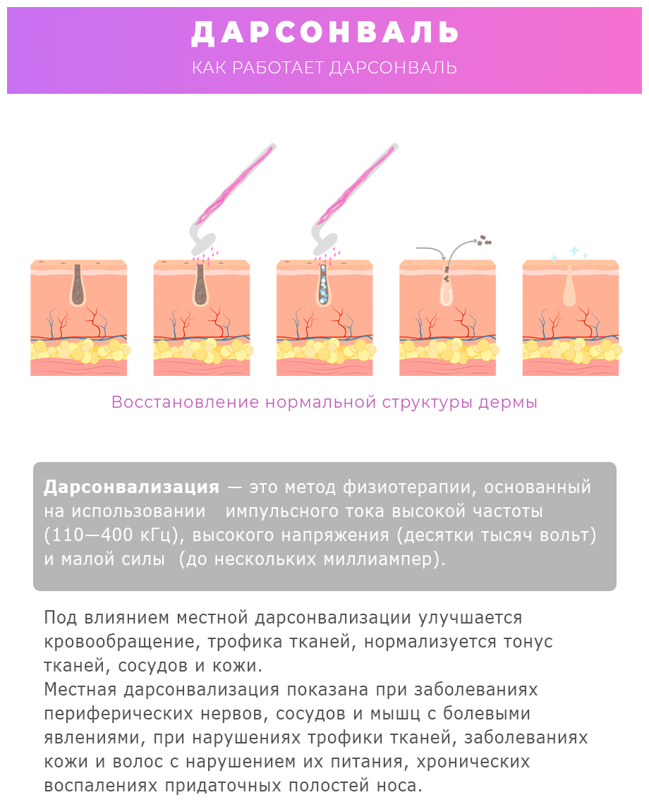 Дарсонваль Benabe MGPC-007 белый - фотография № 7