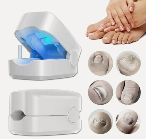 Изображение товара Аппарат для очистки ногтевой пластины Nail Fungus Cleaning Laser Device, для рук, ног, от грибка ногтей, беспроводной