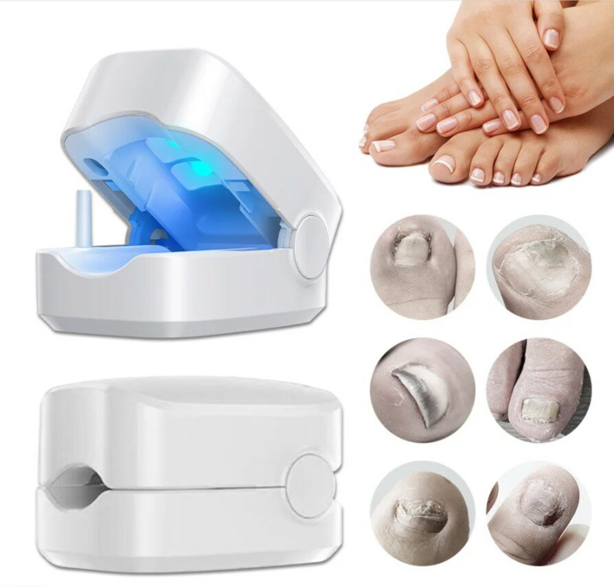 Аппарат для очистки ногтевой пластины Nail Fungus Cleaning Laser Device для рук ног от грибка ногтей беспроводной