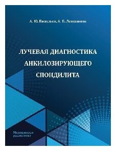 Лучевая диагностика анкилозирующего спондилита