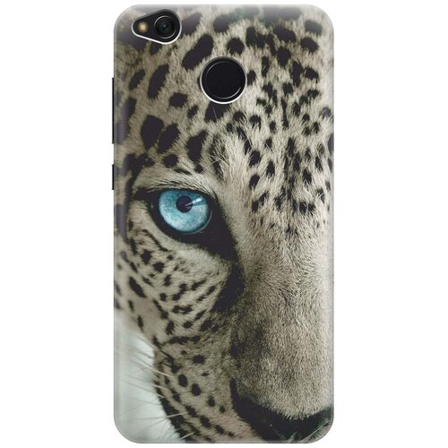 фото Re:paчехол - накладка artcolor для xiaomi redmi 4x с принтом "голубой глаз"