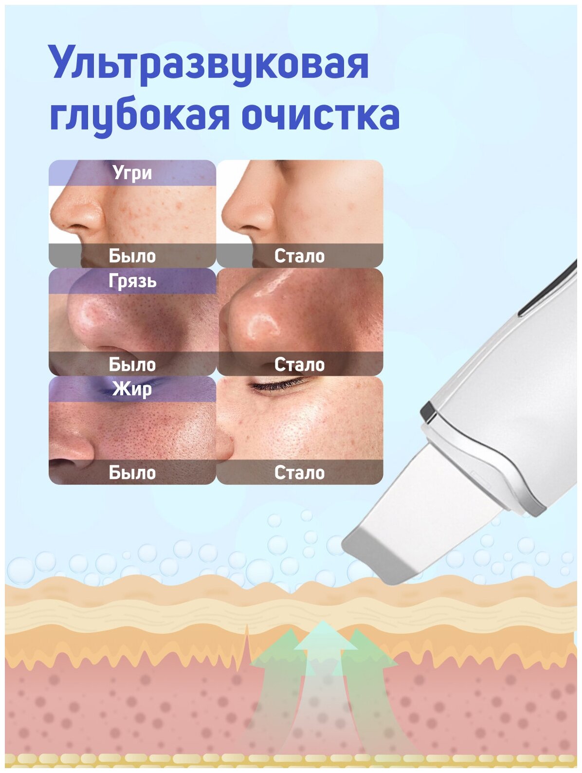 Косметологический аппарат для ультразвуковой чистки лица, лифтинга и увлажнения лица, белый - фотография № 3