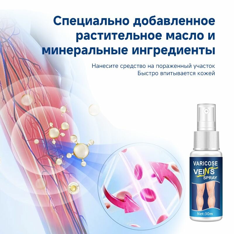 Препараты От Варикозного Расширения Вен Для Инъекций И Инфузий Спрей от варикоза лечение, Эффективен при лечении варикозного расширения вен, сосудистых звездочек, тромбоза, усталости и опухших ног, 30 мл