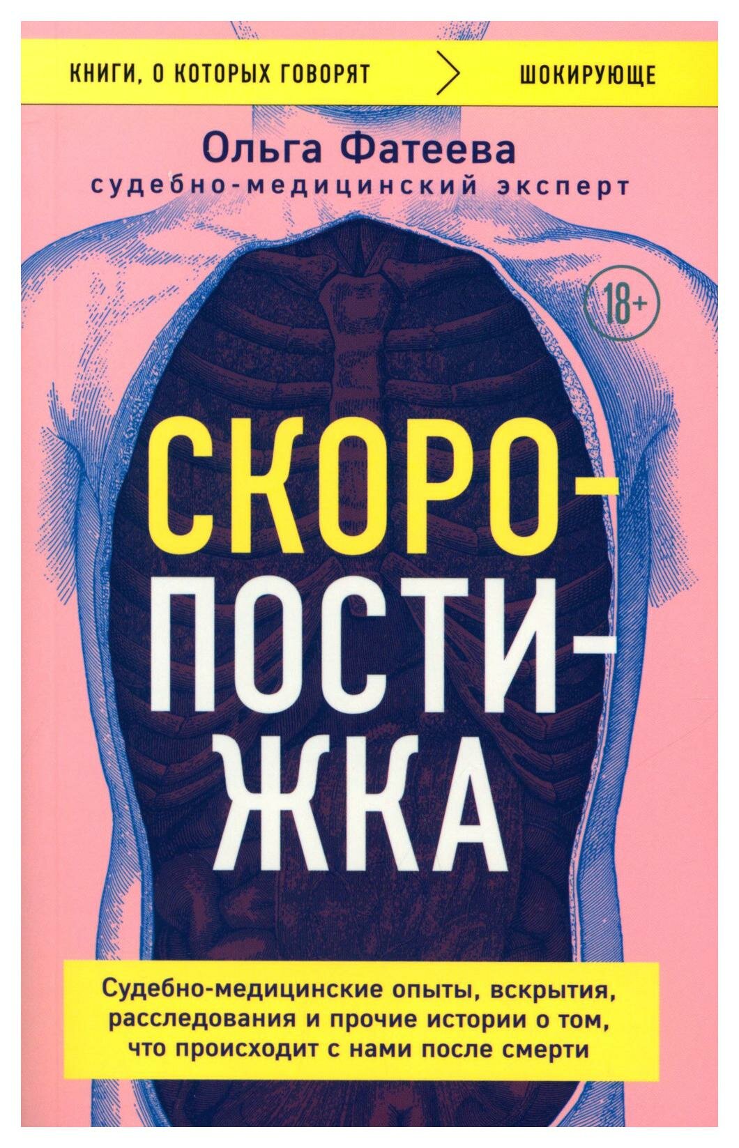 Скоропостижка. Судебно-медицинские опыты, вскрытия, расследования и прочие истории - фото №15