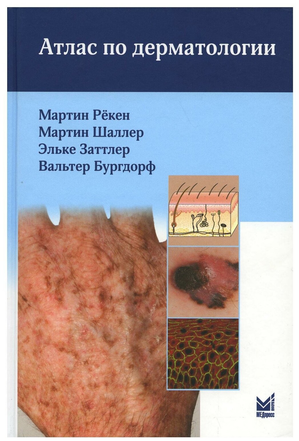 Атлас по дерматологии. 4-е изд